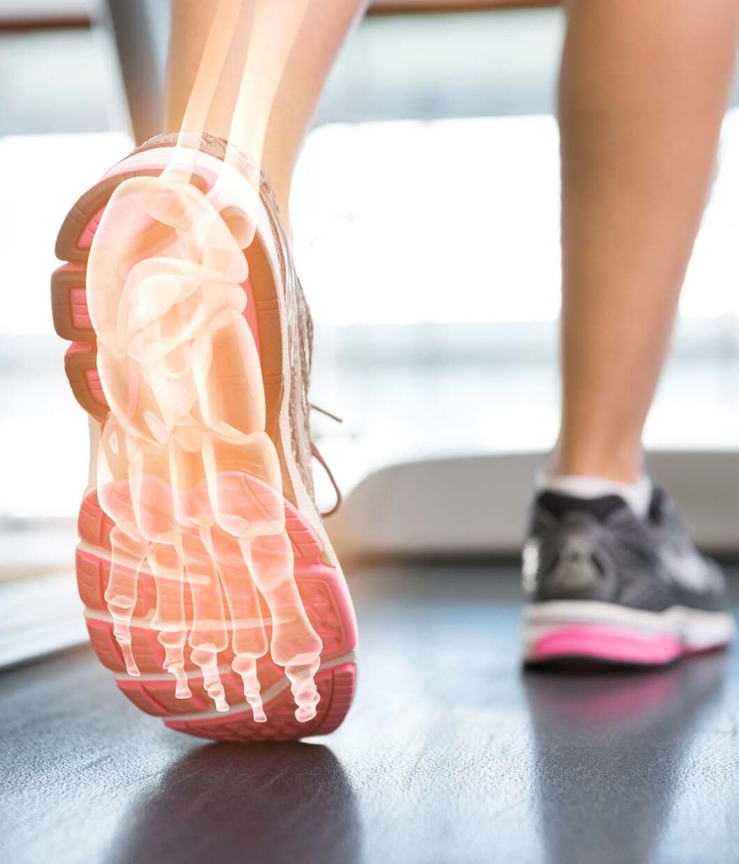Plantarfasziitis Ratgeber