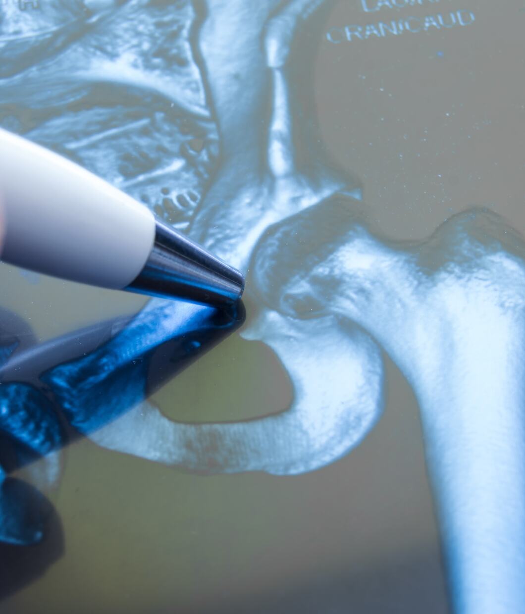 Prinzip Arthrographie
