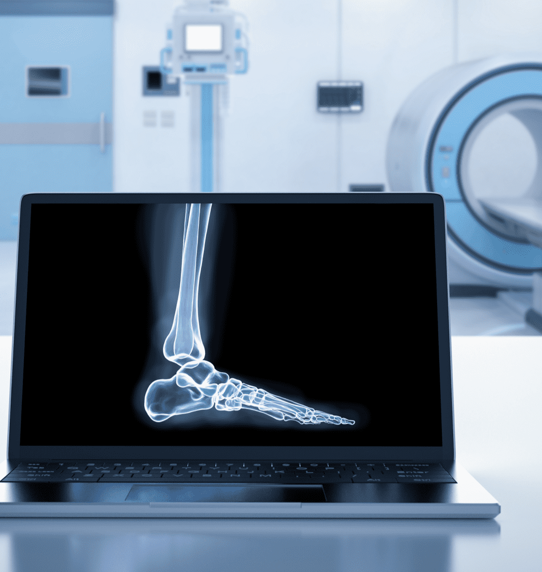 Diagnose Plantarfasziitis