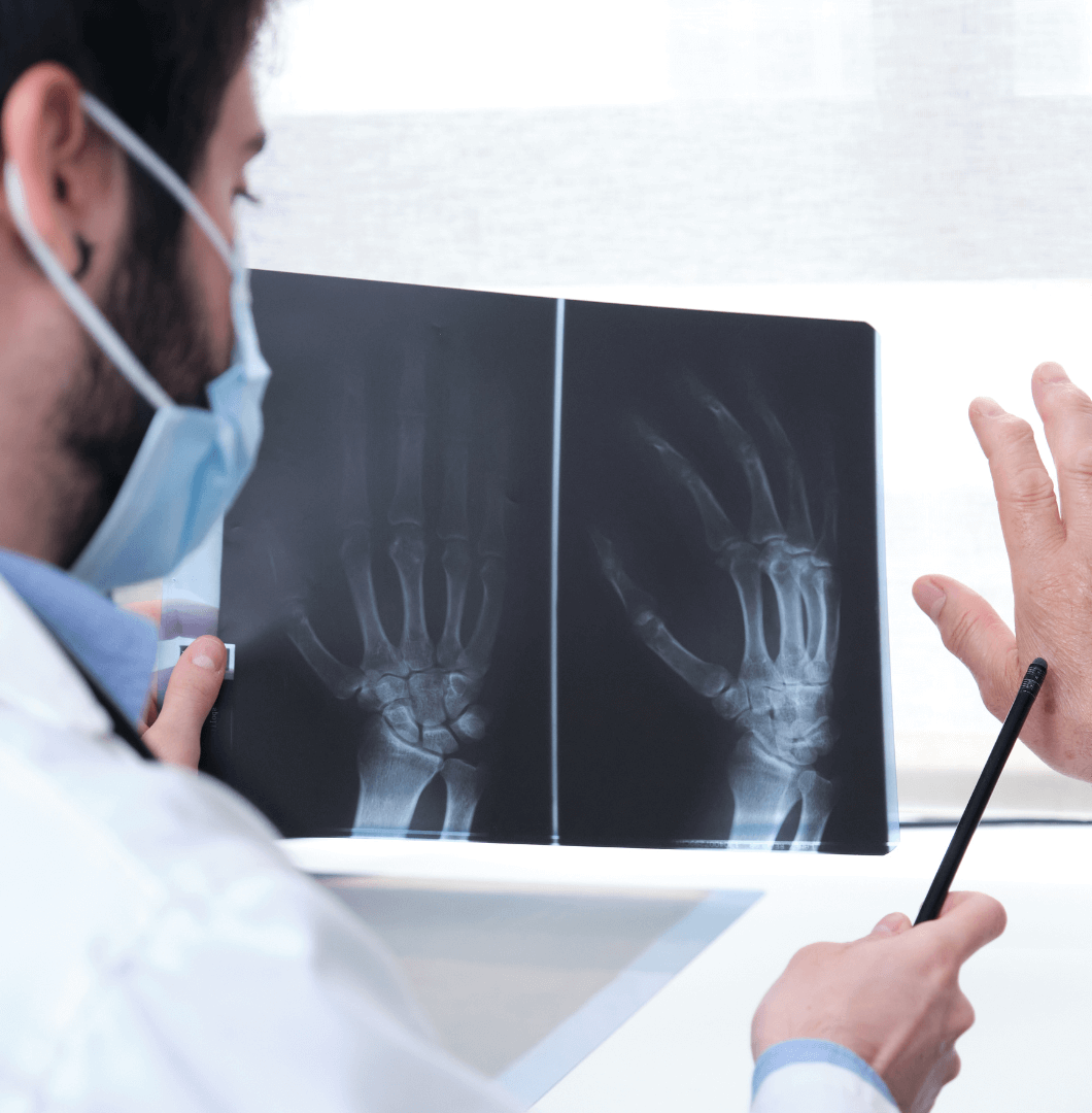 Arthritis Diagnose