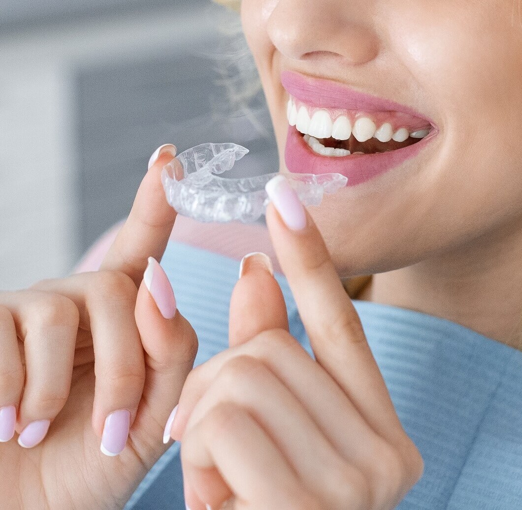 Herausnehmbare Invisalign Schiene