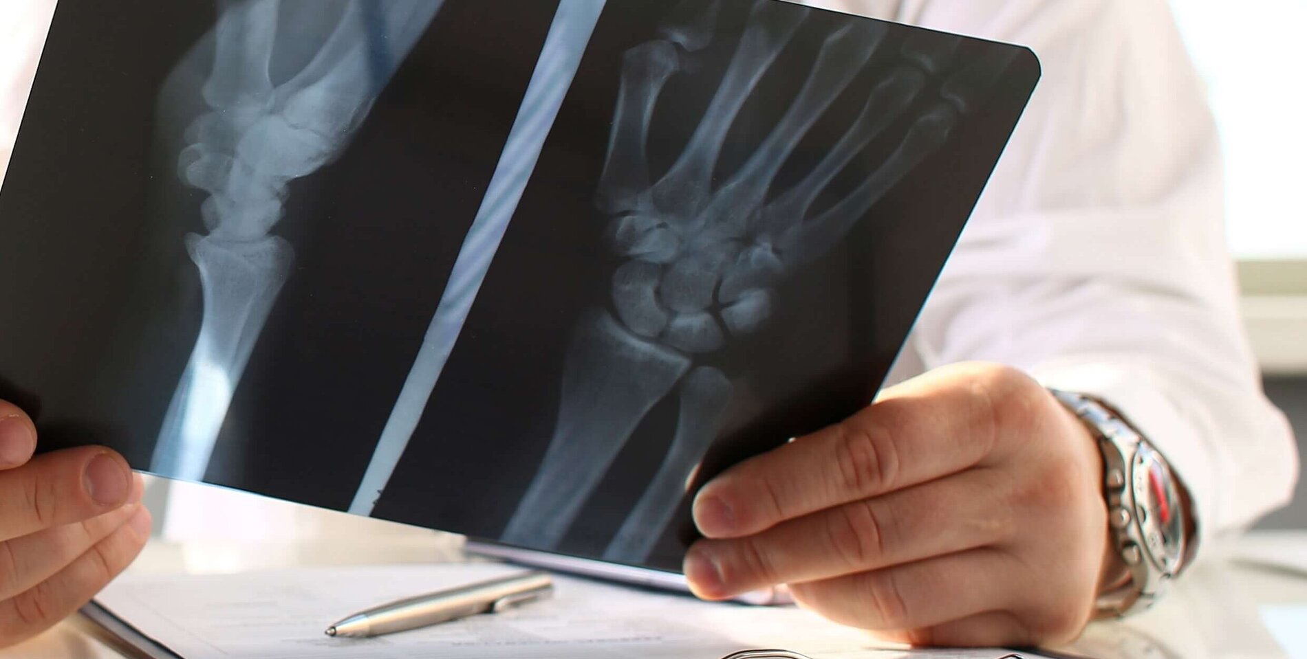 Röntgen Hand