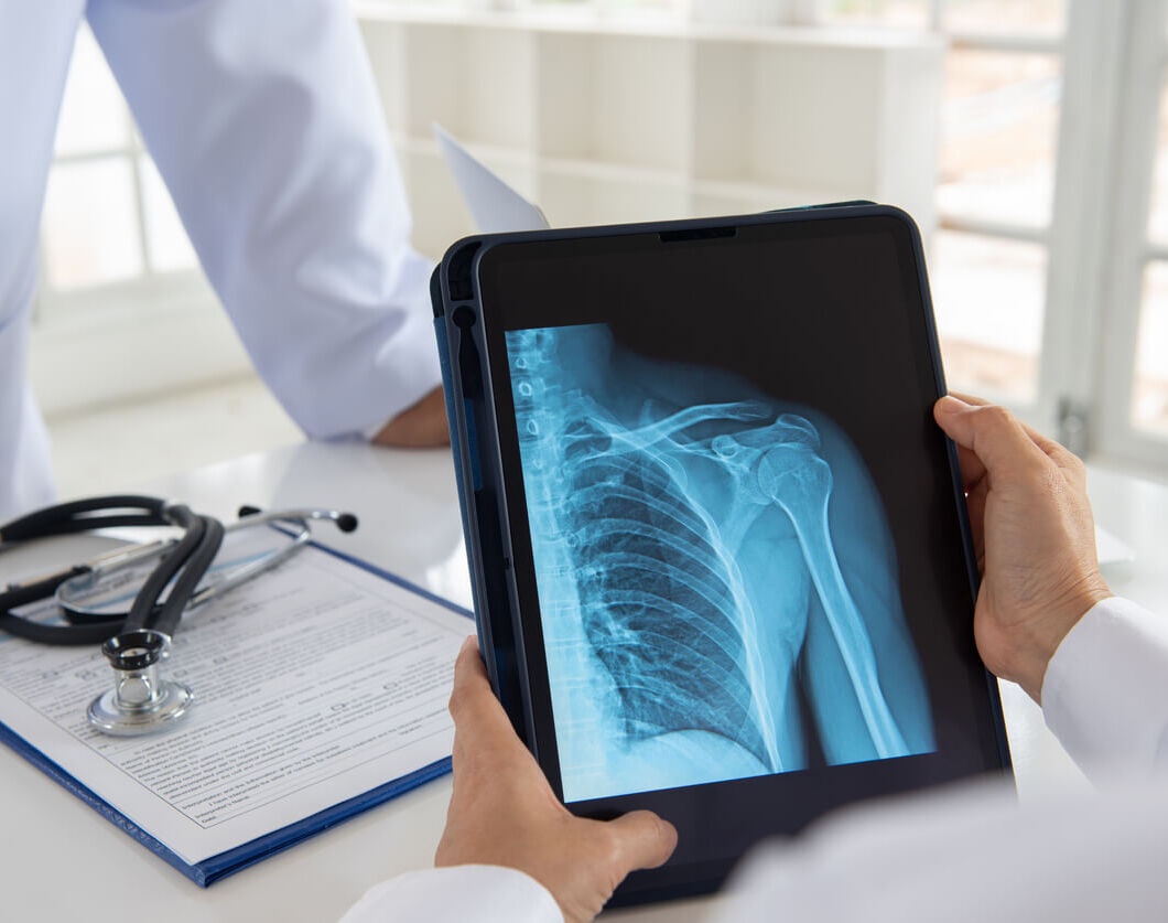 Diagnose Frozen Shoulder